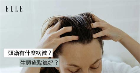 頭生暗瘡|拆解生頭瘡成因！皮膚科醫生教你5大方法擊退頭瘡